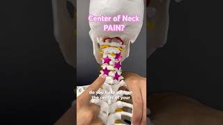 Center of Neck Pain Try This neckpain physicaltherapy physiotherapy chiropractor [upl. by Albion]