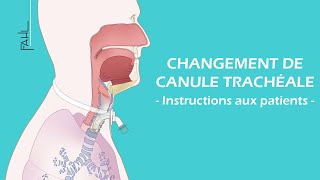 Changement de canule trachéale pour les patients  Animation  Fahl MedizintechnikVertrieb GmbH [upl. by Sophy]