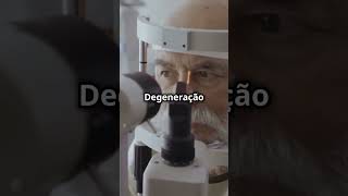 Doenças como a Degeneração Macular afetam milhões de pessoas acima de 50 anos curiosidades [upl. by Anul]