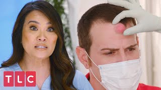 Squeezing a Cyst Off a Patients Forehead  Dr Pimple Popper [upl. by Couhp756]