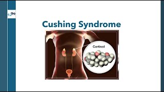 Understanding Cushing Syndrome Essential Knowledge for OPRA Exam [upl. by Ainala]