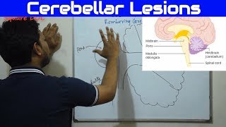 Cerebellar Lesions Made Easy  Bangla Square Doc [upl. by Anivol]