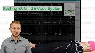 Resting ECG  GE Case System [upl. by Yhtomit]