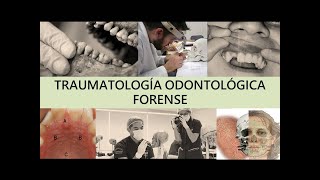 quotTRAUMATOLOGÍA ODONTOLÓGICA FORENSEquot [upl. by Paulson805]