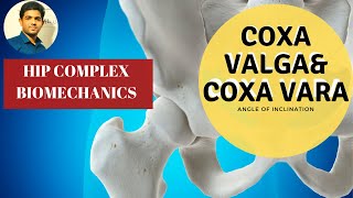 Angle of Inclination Coxa Valga  Coxa Vara Hip Biomechanics [upl. by Rosen]