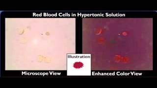 Heme Catabolism and Degradation Pathway  Biochemistry Lesson [upl. by Eastlake700]