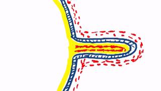 chorionic villi by dr sameh ghazy [upl. by Grata170]