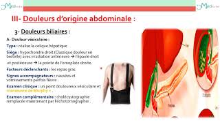 Sémiologie digestive douleurs abdominales [upl. by Owens]