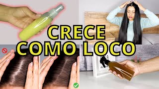 ✅REMEDIOS CASEROS para CRECER el CABELLO en POCOS DIAS😱DEJA DE CAER Y ALINEA😍 [upl. by Lednic115]