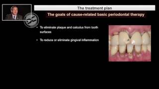 Non surgical periodontal therapy [upl. by Anelrahc]