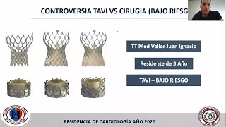 CONTROVERSIA TAVI VS CIRUGIA [upl. by Karita]