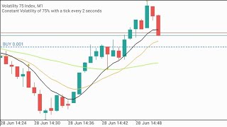 Volatility 75 Index 1 Minute Scalping Strategy and How I Trade it trading forex finance [upl. by Hardwick]