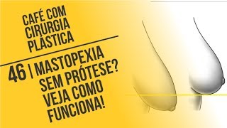 46 Mastopexia sem Prótese Veja como Funciona  Café com Cirurgia Plástica [upl. by Adiazteb]