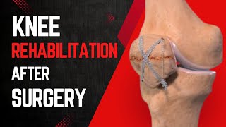 Knee Rehabilitation Exercises PostSurgery  Knee Strengthen Exercises [upl. by Alyak307]