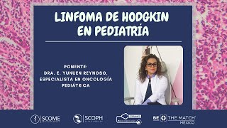 Linfoma Hodgkin en pediatría [upl. by Murrell584]