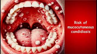 Oral thrush Mucocutaneous candidiasis risk factors HIV immunology microbiology [upl. by Lorenza423]