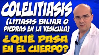 LITIASIS BILIAR PIEDRAS EN LA VESÍCULA ¿Qué pasa dentro del cuerpo de las personas que las padecen [upl. by Apur]