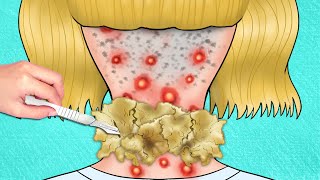 ASMR Remove dandruff flakes on the hairline at the nape of the neck  ASMR Animation [upl. by Ielak]