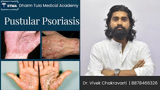 Pustular psoriasis  Psoriasis  Skin Disease  Skin psoriasis psoriasiscure psoriasissolution [upl. by Vonny]