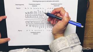 odontograma de signos varinia [upl. by Petrina141]