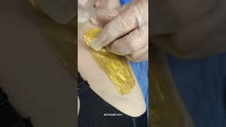 How to Safely Remove Hair with Laser Removal 😱 shorts armpit armpitwax bodyhairremoval [upl. by Lysander306]