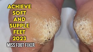 Cracked Heels Treatment Achieve Soft and Supple Feet by famous Miss Foot Fixer [upl. by Fiedling122]