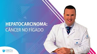 Hepatocarcinoma Câncer no Fígado [upl. by Martainn]