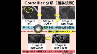 Goutallier分類（脂肪浸潤）音声解説☺︎ [upl. by Ennayar]