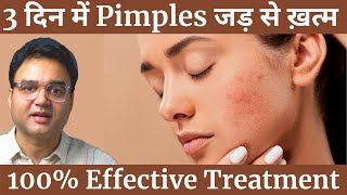 Pimples को बोलो अलविदा  4 Simple Steps To Remove Pimples amp Get Clear Spotless Skin Naturally [upl. by Novar]