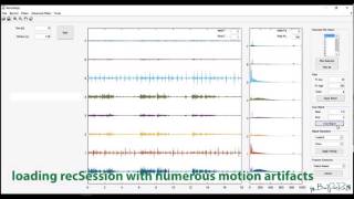 BioPatRec Signal denoising [upl. by Johppa]