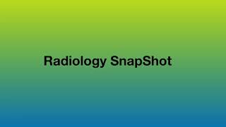 Renal Angiomyolipoma [upl. by Poole]