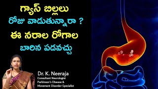 Neuro Problems Caused Due to Use of Gas Tablets In Long Run  Dr K Neeraja  Neurologist  Guntur [upl. by Nylarej]