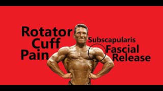 Rotator Cuff Pain  Subscapularis Fascial Release [upl. by Geilich]