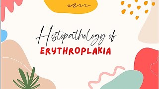 FUN WITH HISTOPATHOLOGY 10 ERYTHROPLAKIA [upl. by Klockau]