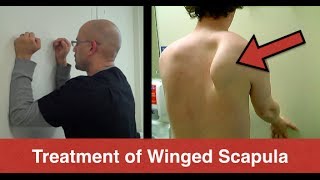 BEST Winged Scapula Exercises Fix Scapular Winging Treatment  Serratus Anterior Exercises [upl. by Sprague661]