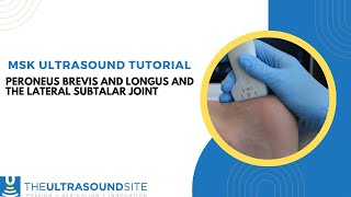 Musculoskeletal ultrasound of Peroneus longus and Peroneus brevis and the lateral subtalar joint [upl. by Werdnaed]