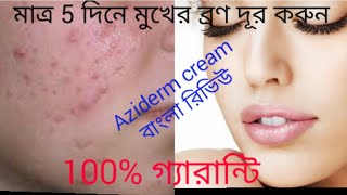 AZIDERM CREAM Bangla Review [upl. by Otrebire968]