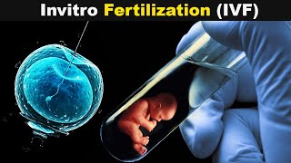 IVF Procedure Step by Step  In Hindi IVF Step by Step Process Basic test During Before IVF [upl. by Adkins]