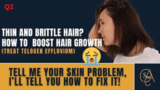 THIN AND BRITTLE HAIR HOW TO BOOST HAIR GROWTH TREAT TELOGEN EFFLUVIUM [upl. by Selrahc]