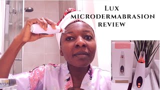 I tried the Lux microdermabrasion kit Does the Lux microdermabrasion work Product review [upl. by Sander]