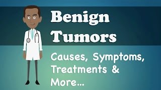 Benign Tumors  Causes Symptoms Treatments amp More… [upl. by Capps]