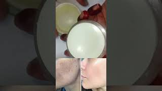 Best pigmentation removal cream 😯pigmentationsolution pigmentation pigmentationtreatmentathome [upl. by Landau]