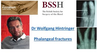 Phalangeal fractures by Dr Wolfgang Hintringer [upl. by Ahtennek]