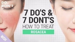 14 Tips for Rosacea That Really Work  Effective Skin Care Tips for Rosacea  Do amp Dont [upl. by Ineslta242]