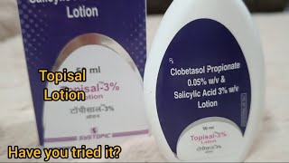 Topisal lotion for dry flaky scalp [upl. by Lunetta509]