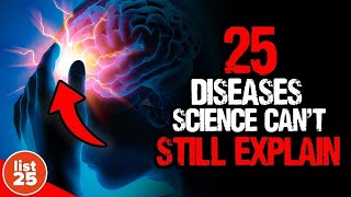 25 Mind Boggling Diseases That Science Cant Explain [upl. by Engenia]