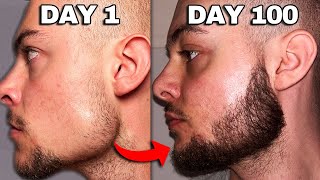 I Used Minoxidil On My Beard For 100 Days Before  After Results [upl. by Riabuz166]