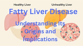 Causes of Fatty Liver Disease Understanding Its Origins and Implications [upl. by Rodmann894]