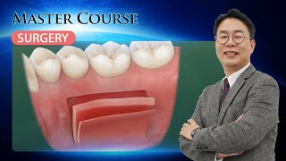 Master Course  SURGERY How to Successfully Master FGG and CTG Procedures [upl. by Haldane152]