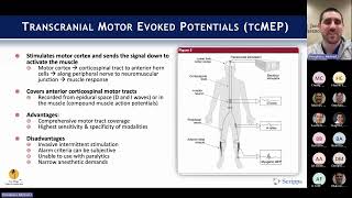 Intraoperative Neuromonitoring with Michael Pompliano MD on March 4 2024 [upl. by Rogerson319]